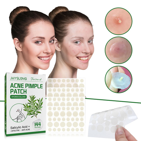 Acne Pimple Patches 144Ct